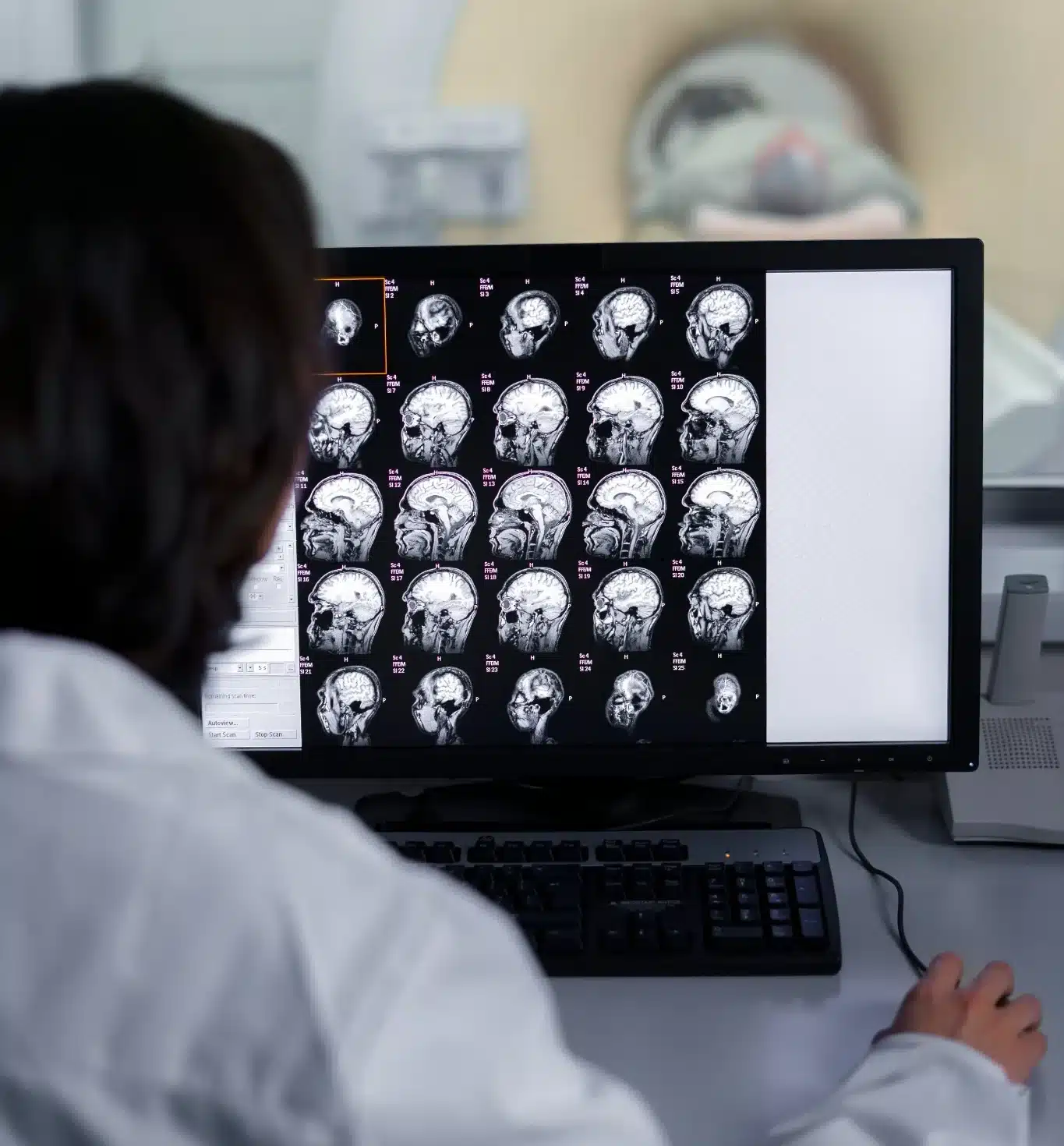 Profissional da saúde analisando exames cerebrais relacionados ao tratamento do Alzheimer