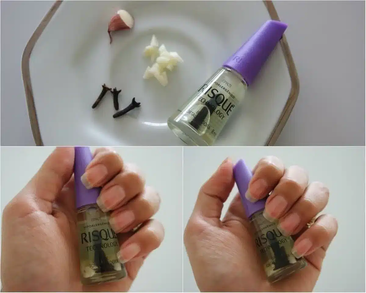 Fortalecedor de unhas caseiro com cravo e alho mostrando frasco e unhas naturais