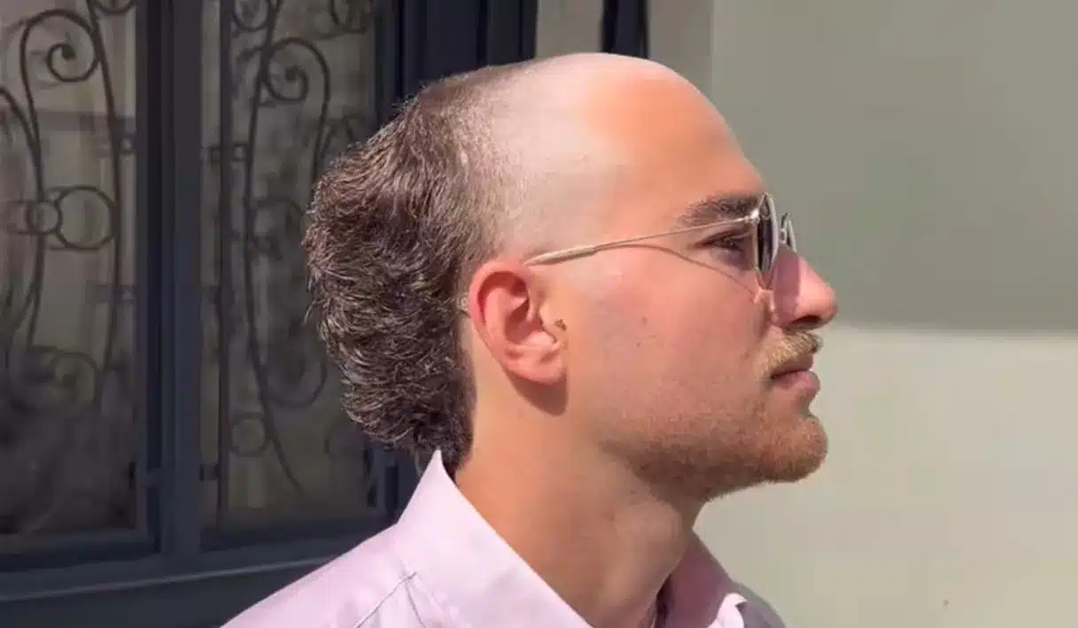 Homem com corte de cabelo estilo meio calvo, tendência de corte masculino para 2025