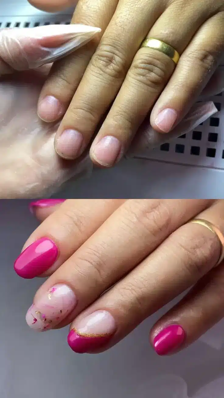 Antes e depois da aplicação de unhas de gel com esmalte rosa e detalhes dourados.